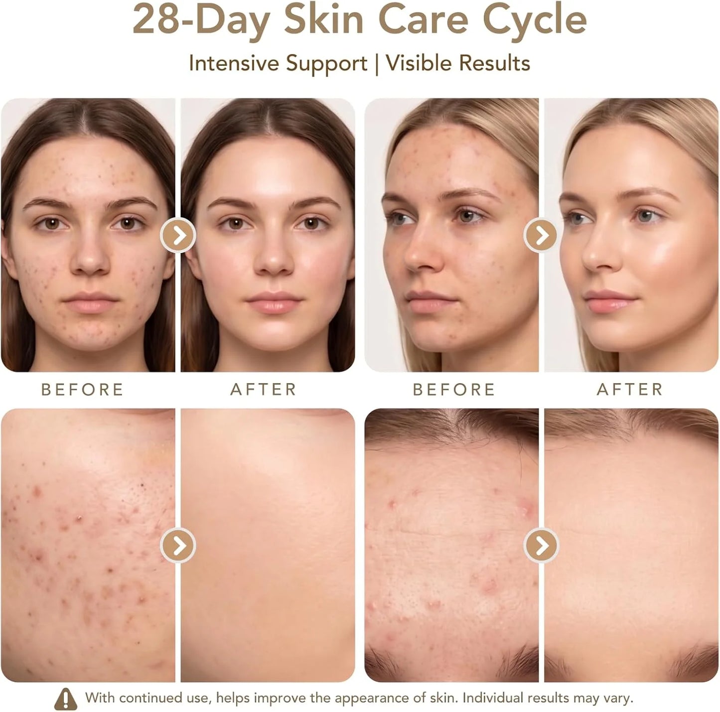 Dr. pen Ultima M9 Microneedling Pen