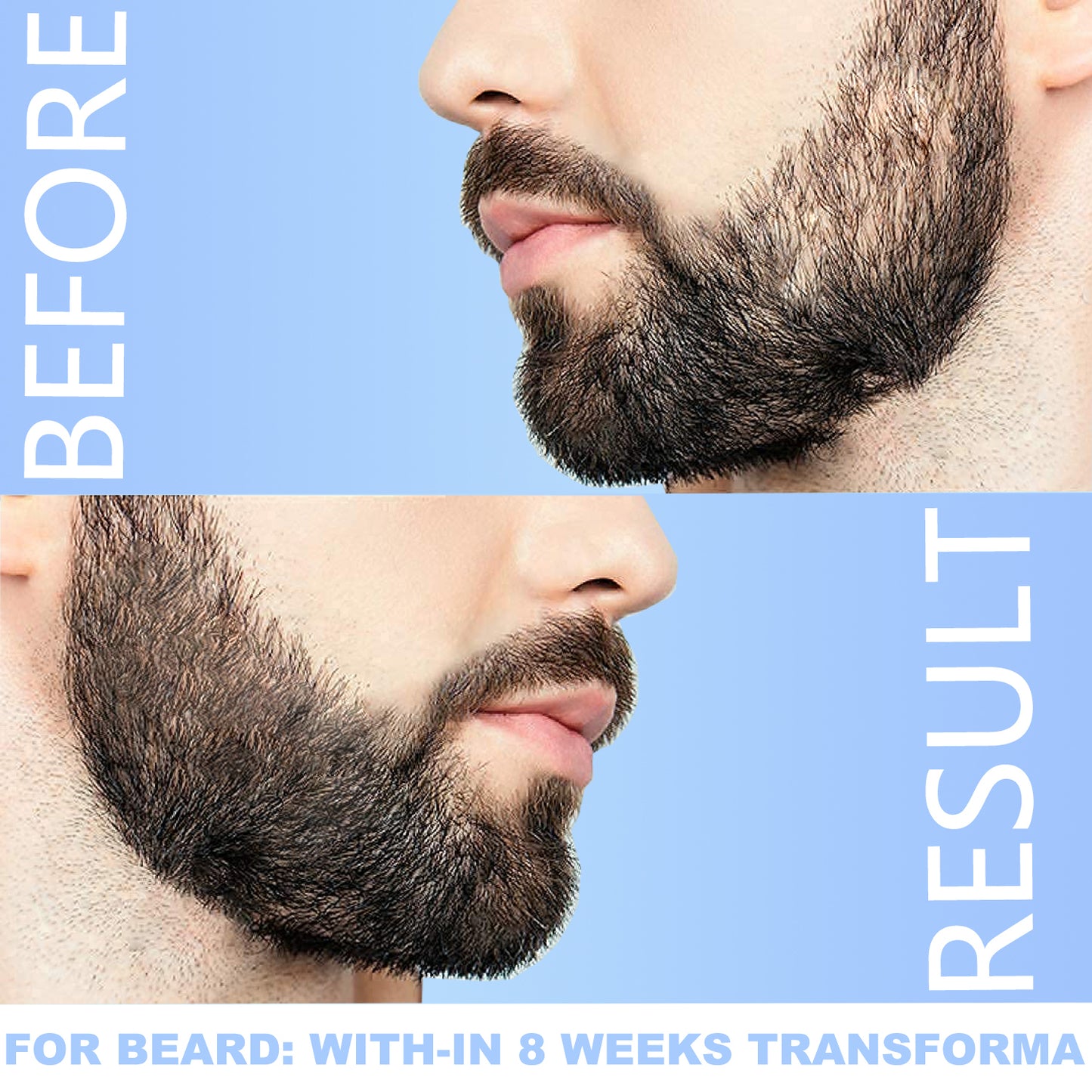 Derma Roller 540 Titanium Microneedling Roller