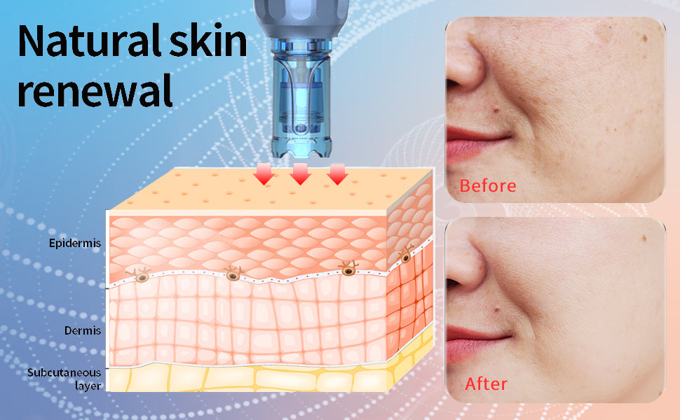 Dr. pen Ultima A9 Microneedling Pen